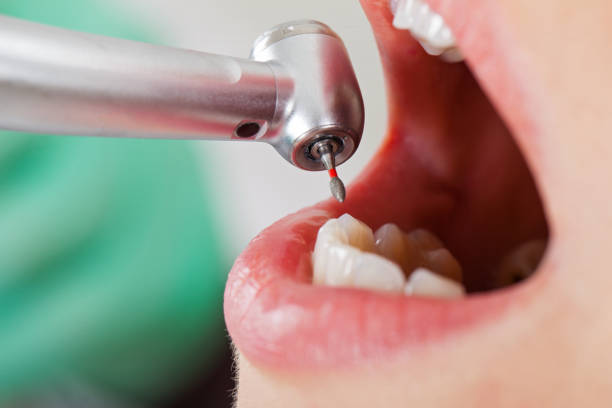 Best Emergency Dental Care for Broken or Chipped Teeth in Dillon, SC